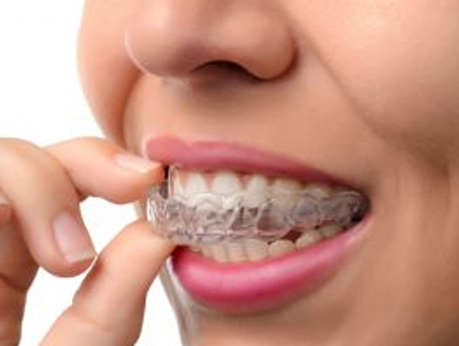 image-Orthodontics-opt
